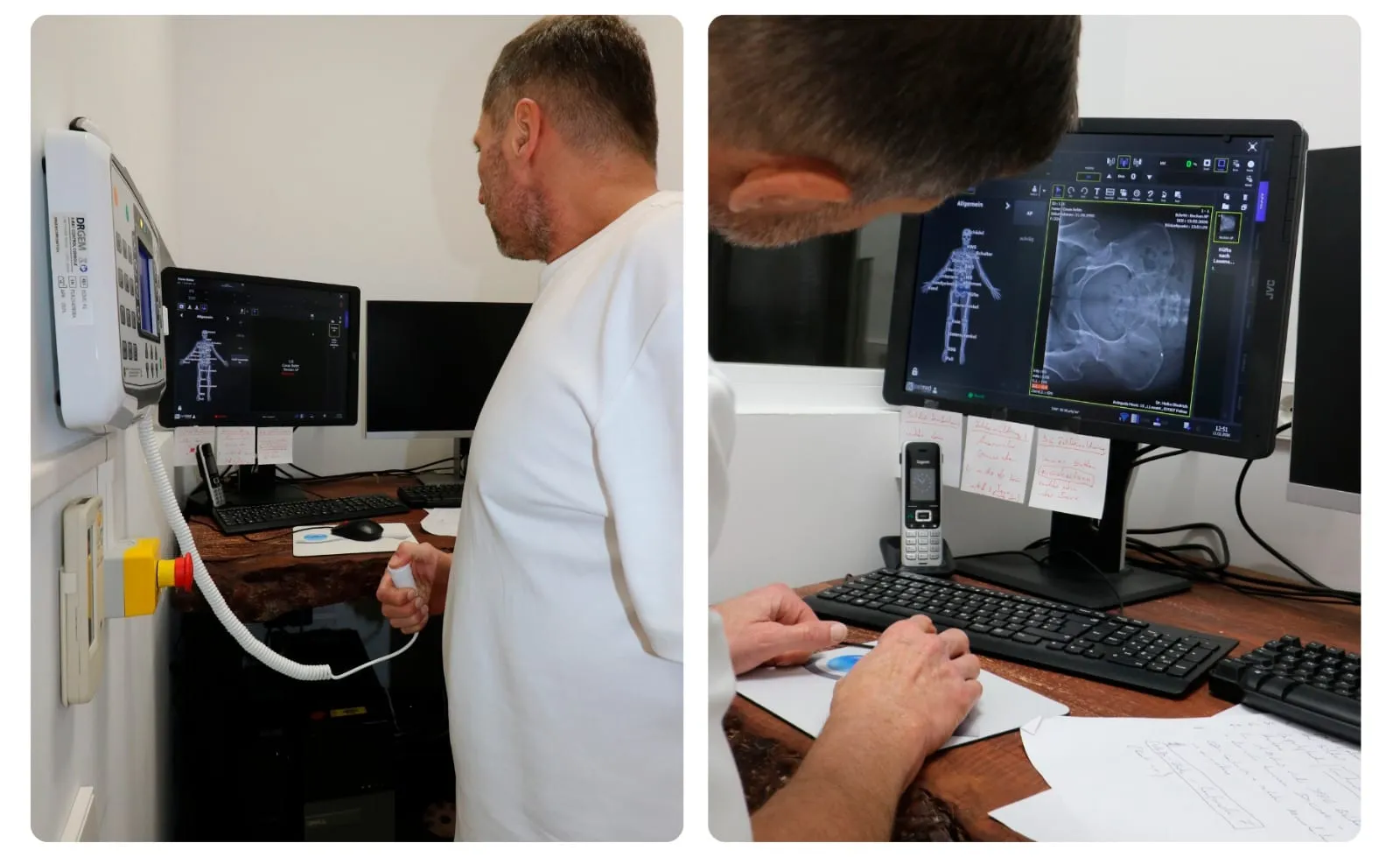 Densitometría ósea DEXA detalle